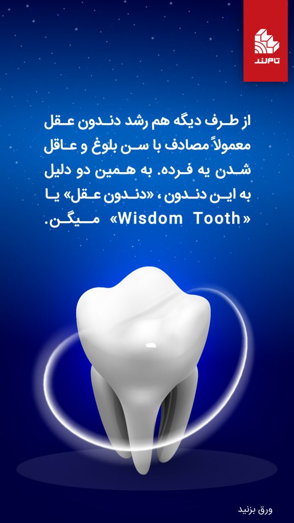 دندان عقل۶